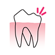 Dentihex - Dental pain