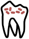 Dentihex - Treatment of periodontal disease